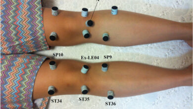 Complete Guide to Acupuncture