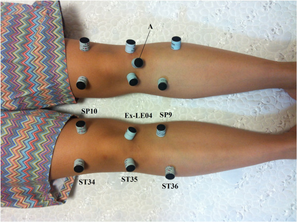 Complete Guide to Acupuncture